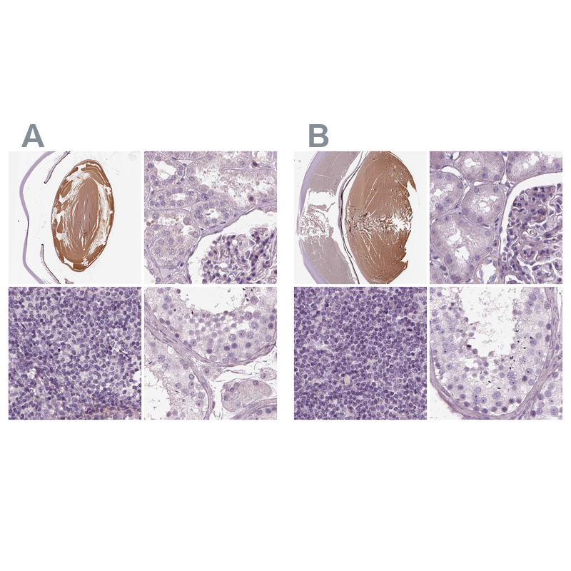 <b>Independent Antibodies Validation. </b>Staining of human eye, kidney, lymph node and testis using NBP1-91903 (A) shows similar protein distribution across tissues to independent antibody NBP1-91902 (B).