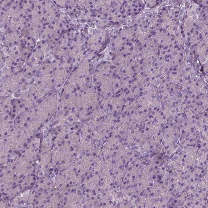 Staining of human pancreas shows no positivity in exocrine glandular cells as expected.
