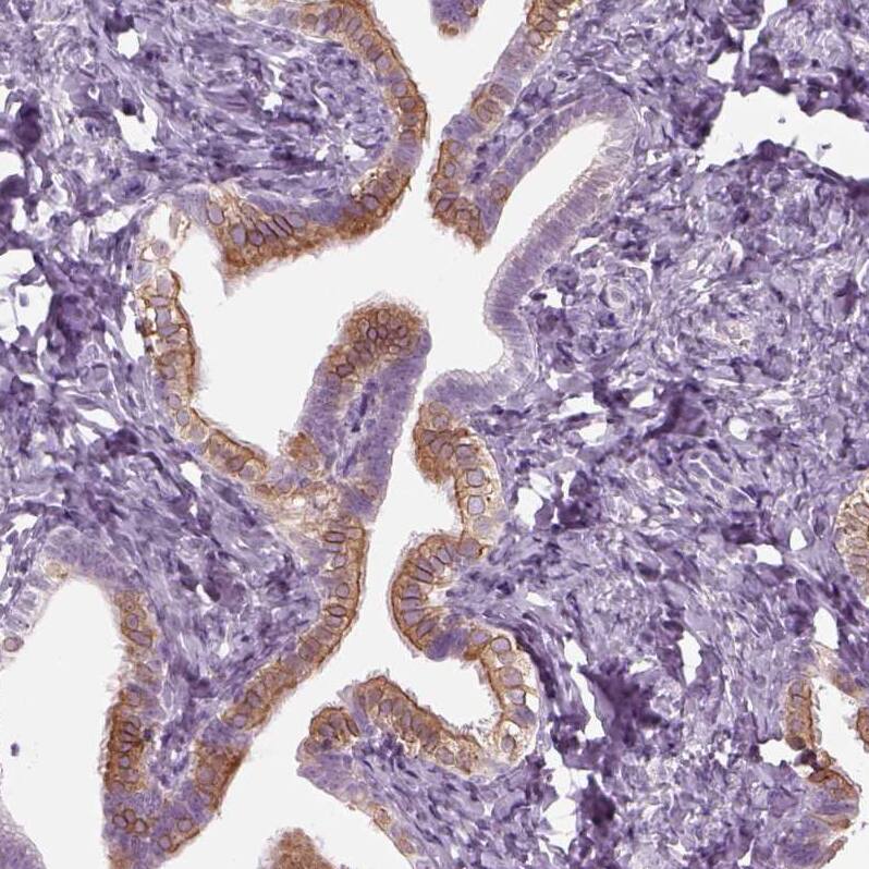 Staining of human fallopian tube shows moderate  membranous positivity in ciliated glandular cells.