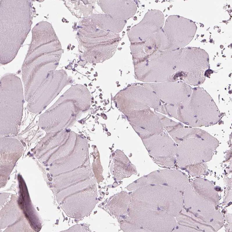 Staining of human skeletal muscle shows no positivity in myocytes as expected.