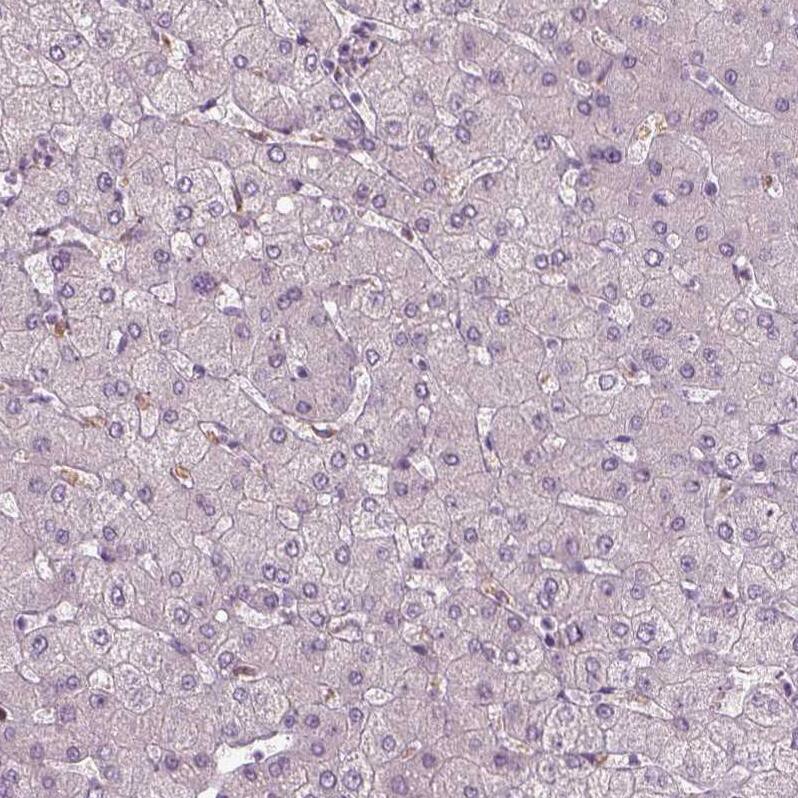 Staining of human liver shows no positivity in hepatocytes as expected.