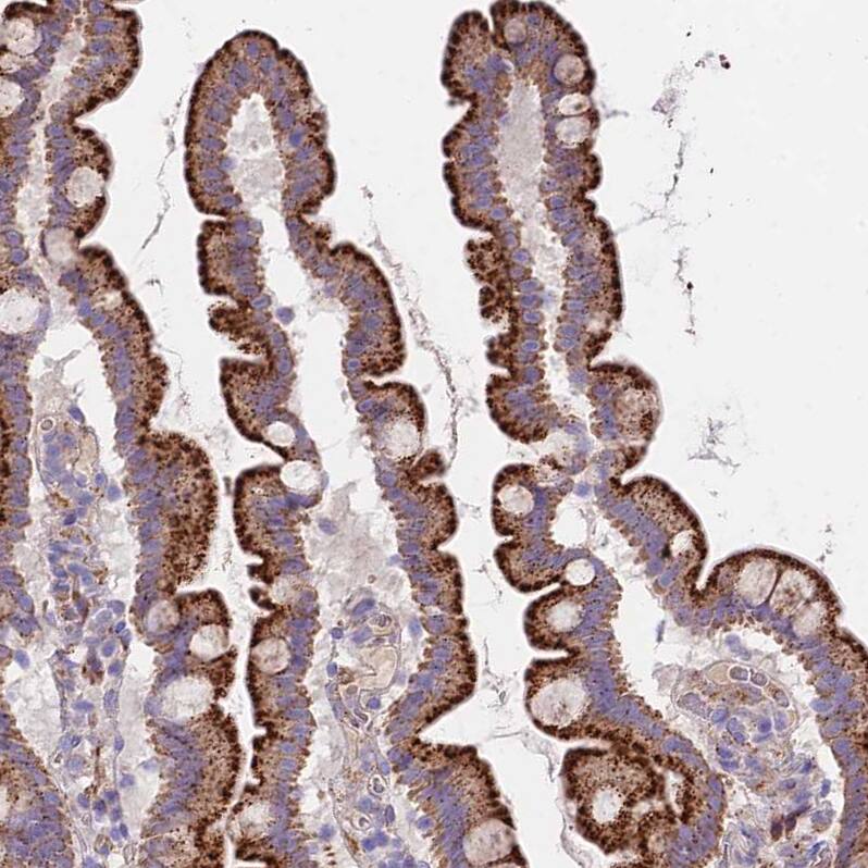 Immunohistochemistry FRMPD1 Antibody - BSA Free