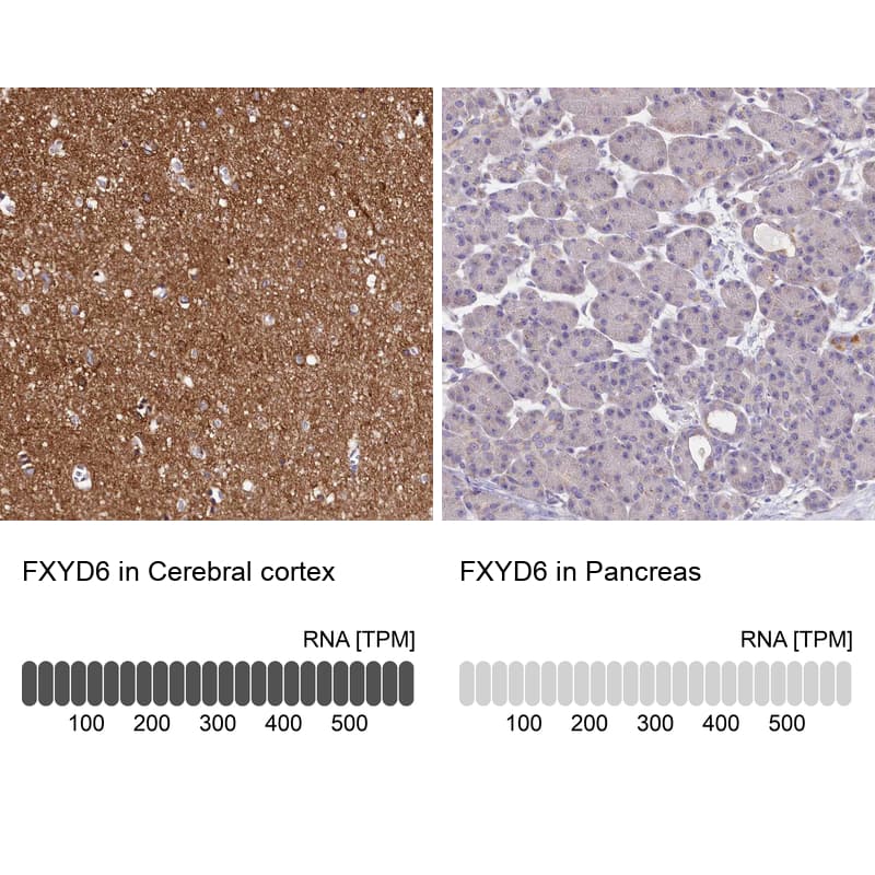 Immunohistochemistry-Paraffin FXYD6 Antibody - BSA Free
