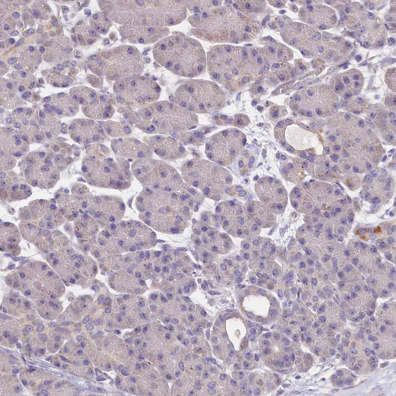 Staining of human pancreas shows no positivity in exocrine glandular cells as expected.