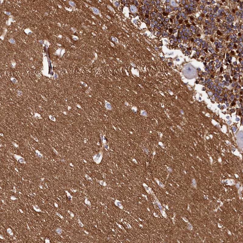 Staining of human cerebellum shows strong membranous positivity in cells in molecular layer.