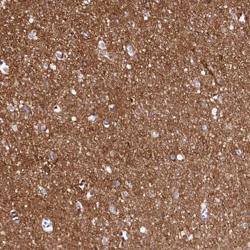 Staining of human cerebral cortex shows strong membranous positivity in neuropil.
