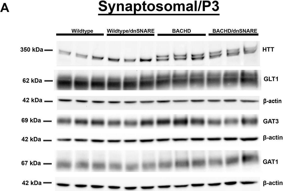 Glutamate and GABA transporter levels in the synaptosomal fraction. (A) Representative western blots of glutamate and GABA transporter protein expression in wild-type, wild-type/dnSNARE, BACHD and BACHD/dnSNARE mice. (B) Western blot quantification of the transporters (shown are n=3 independent samples). HTT was probed to confirm the genotype of sample mice on the same blot probed for GAT1 (same  beta -actin loading control as shown for GAT1). No significant difference was observed in GLT1, GAT3 and GAT1 (n=5-6/genotype). Data are mean+/-s.e.m. Differences among the groups were assessed by one-way ANOVA followed by Tukey's HSD multiple comparison procedure. Non-significant P-values are not displayed on graphs. Refer to Table 1 for all P-values. Image collected and cropped by CiteAb from the following open publication (//pubmed.ncbi.nlm.nih.gov/39526491), licensed under a CC-BY license. Not internally tested by Novus Biologicals.