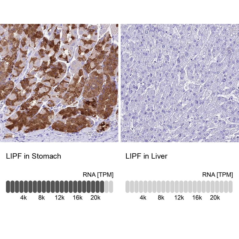 Analysis in human stomach and seminal vesicle tissues using Anti-LIPF antibody. Corresponding LIPF RNA-seq data are presented for the same tissues.