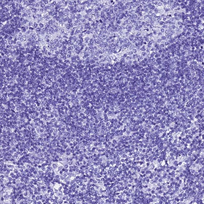 Staining of human seminal vesicle shows low expression as expected.