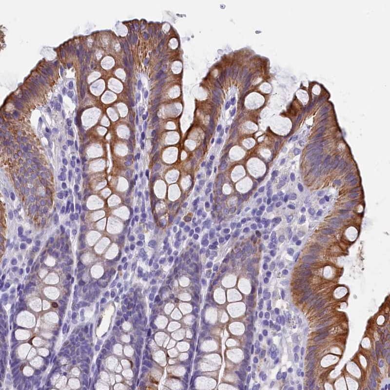 Staining of human colon shows moderate membranous and cytoplasmic positivity in glandular cells.