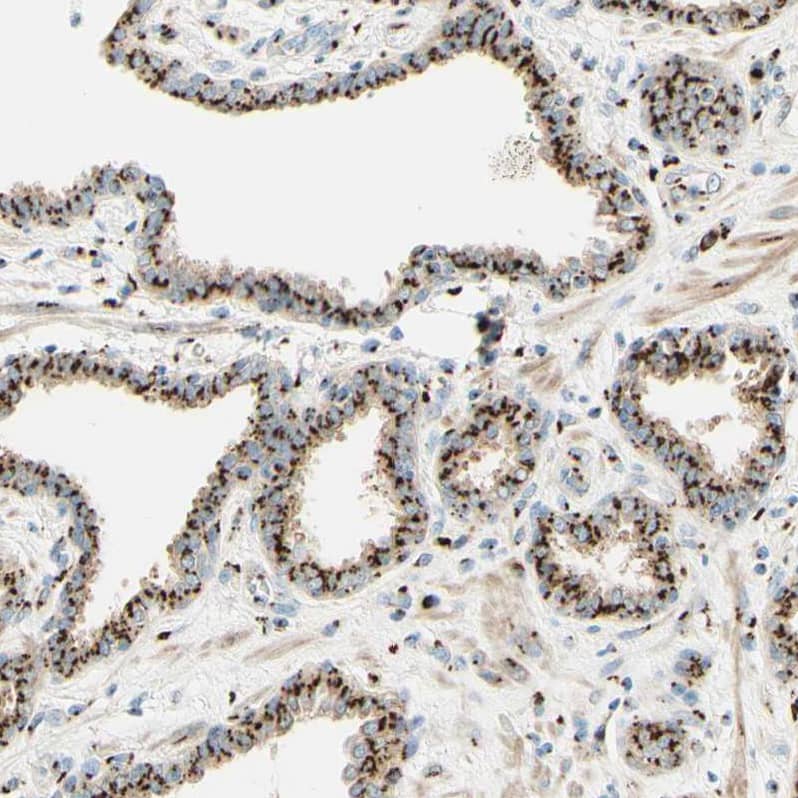 Staining of human prostate shows strong positivity in Golgi apparatus in glandular cells.