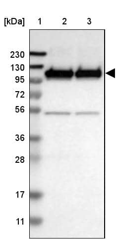 Western Blot Glutamate Receptor 6 Antibody - BSA Free