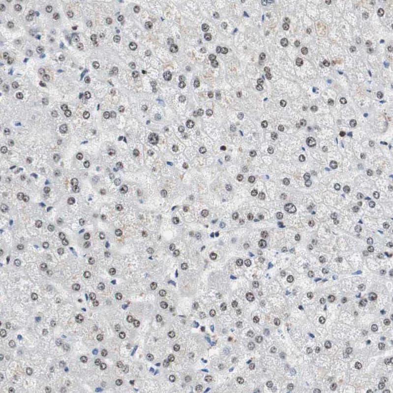Staining of human liver shows moderate nuclear and nucleoli positivity in hepatocytes.
