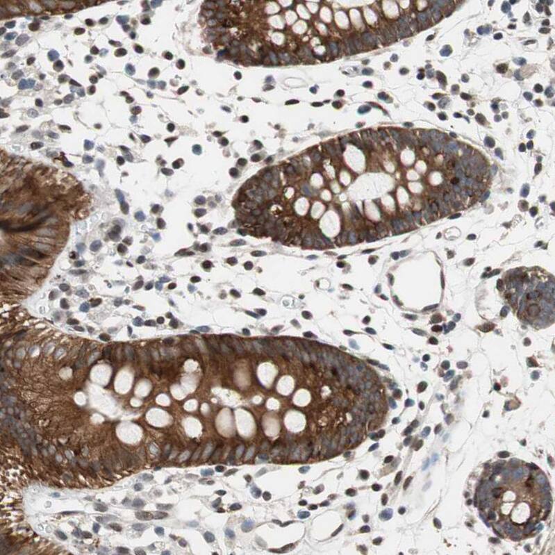 Staining of human colon shows moderate to nuclear positivity in lymphoid cells.