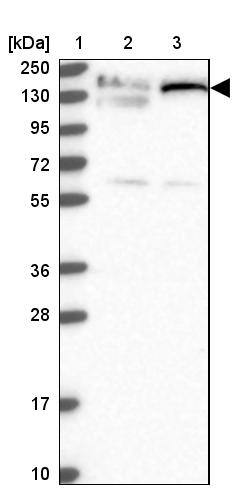 Lane 1: Marker [kDa] 250, 130, 95, 72, 55, 36, 28, 17, 10Lane 2: Human cell line RT-4Lane 3: Human cell line U-251MG sp