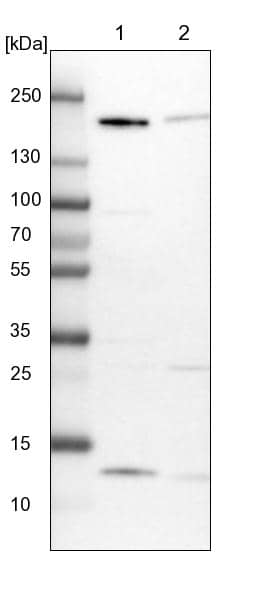 Lane 1: NIH-3T3 cell lysate (Mouse embryonic fibroblast cells)Lane 2: NBT-II cell lysate (Rat Wistar bladder tumour cells)