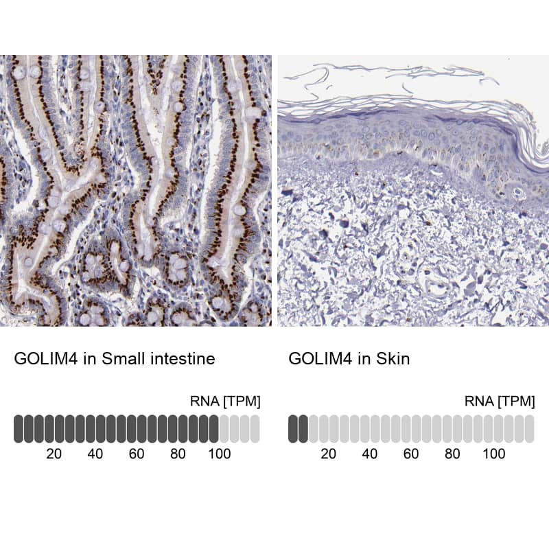 Immunohistochemistry GOLPH4 Antibody - BSA Free