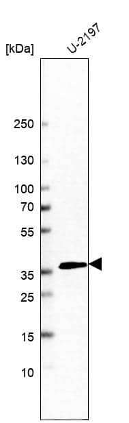 Analysis in human cell line U-2197.
