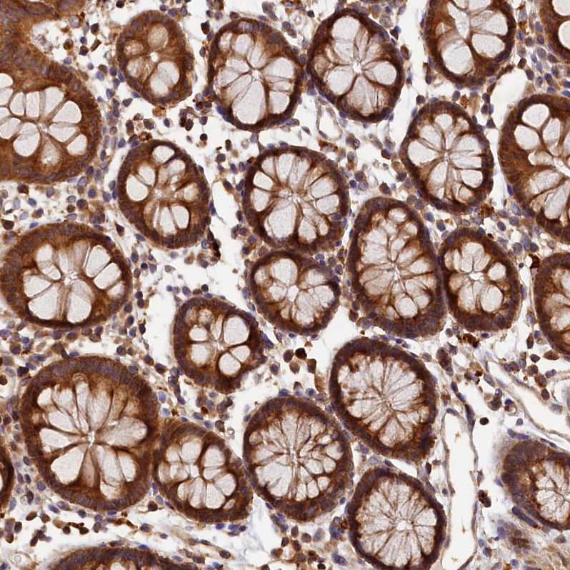 Staining of human colon shows strong granular cytoplasmic positivity in glandular cells.