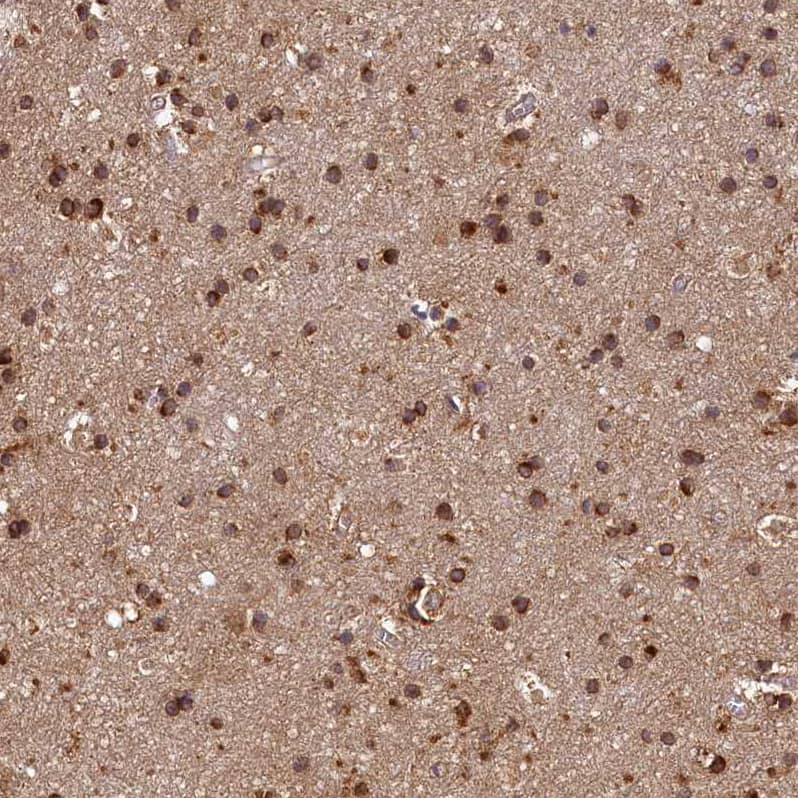 Staining of human cerebral cortex shows moderate granular cytoplasmic positivity in glial cells.