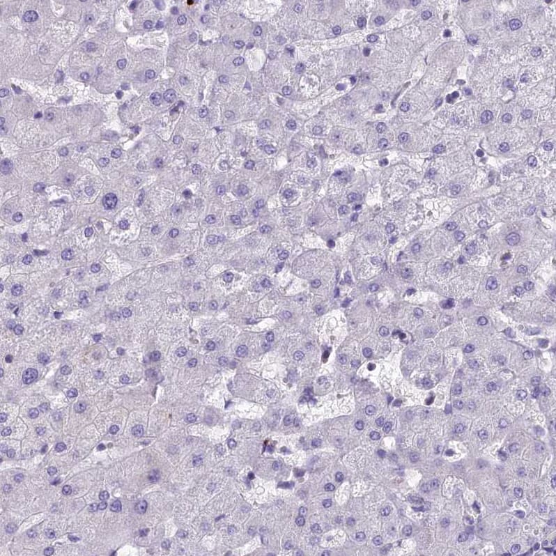 Staining of human liver shows no positivity in hepatocytes as expected.