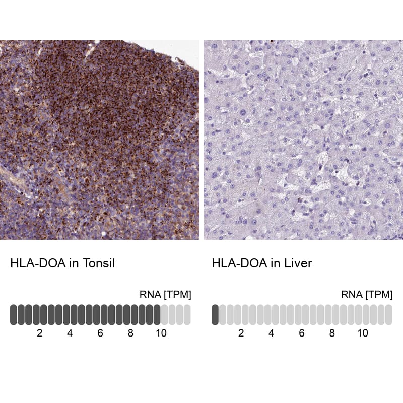Analysis in human tonsil and liver tissues using NBP1-91993 antibody. Corresponding HLA-DOA RNA-seq data are presented for the same tissues.