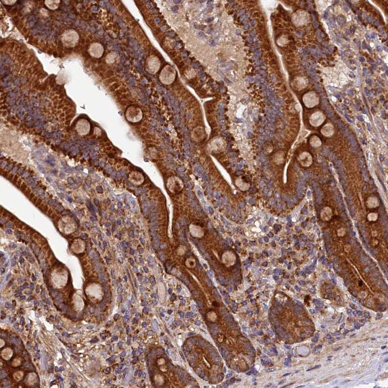 Staining of human duodenum shows strong cytoplasmic positivity in glandular cells.