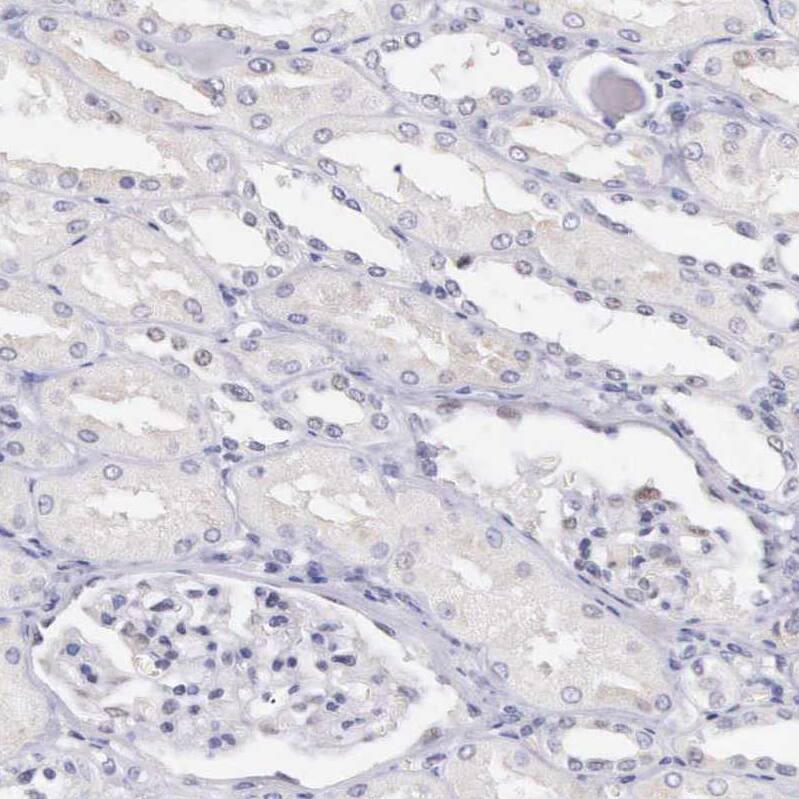 Immunohistochemistry HMG2L1 Antibody - BSA Free