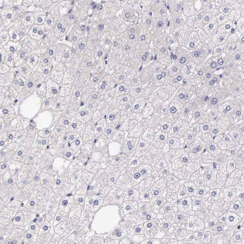 Immunohistochemistry HMG2L1 Antibody - BSA Free