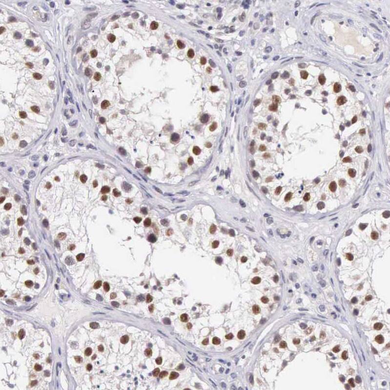 Immunohistochemistry HMG2L1 Antibody - BSA Free