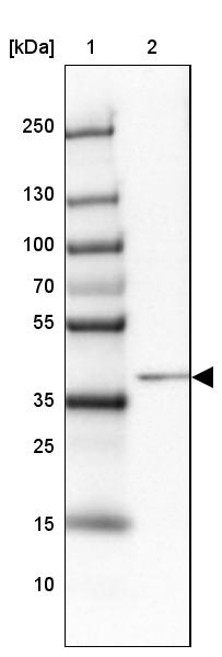 Lane 1: Marker [kDa] 250, 130, 100, 70, 55, 35, 25, 15, 10Lane 2: Human Liver tissue