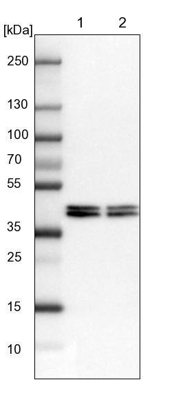 Lane 1: NIH-3T3 cell lysate (Mouse embryonic fibroblast cells)Lane 2: NBT-II cell lysate (Rat Wistar bladder tumour cells)