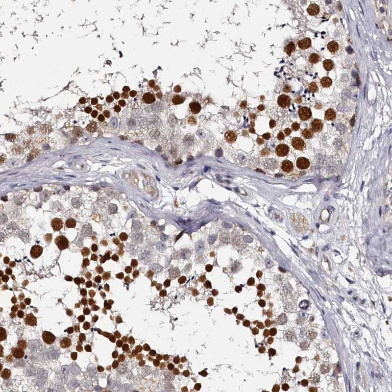 Immunohistochemistry-Paraffin HNRPGT Antibody - BSA Free