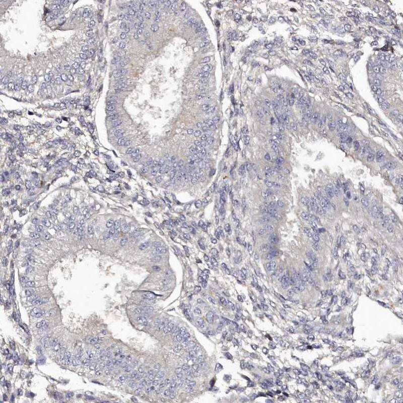 Immunohistochemistry-Paraffin HNRPGT Antibody - BSA Free
