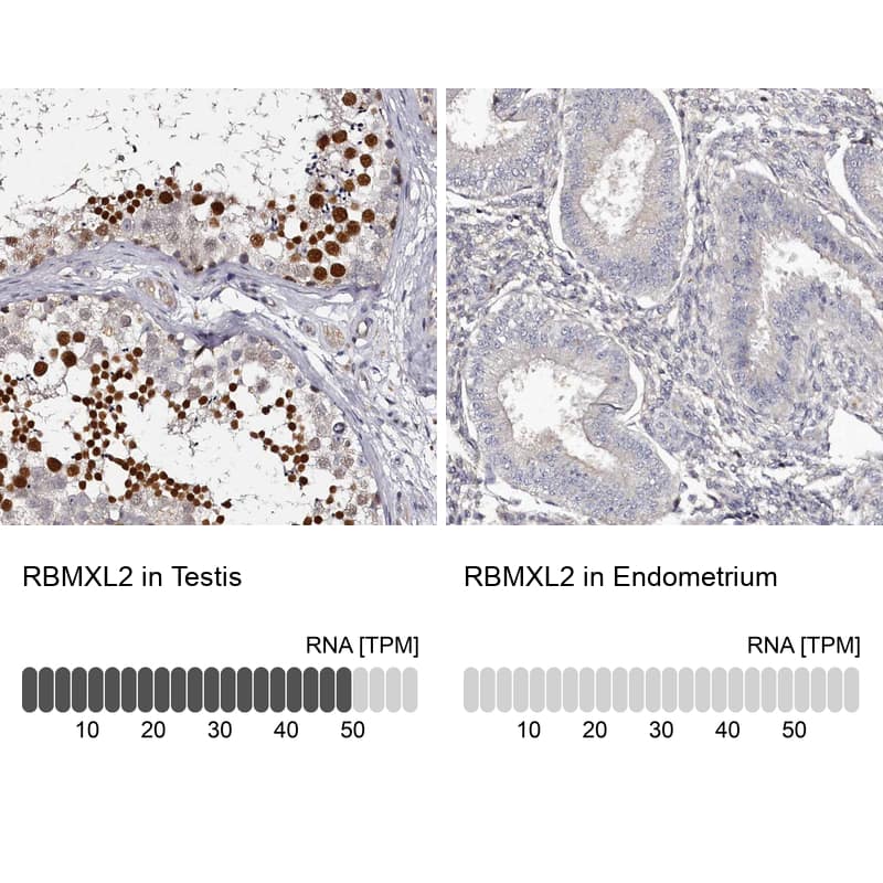<b>Orthogonal Strategies Validation. </b>Analysis in human testis and endometrium tissues using Anti-RBMXL2 antibody. Corresponding RBMXL2 RNA-seq data are presented for the same tissues.