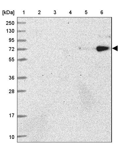 Lane 1: Marker [kDa] 250, 130, 95, 72, 55, 36, 28, 17, 10Lane 2: Human cell line RT-4Lane 3: Human cell line U-251MG spLane 4: Human plasma (IgG/HSA depleted)Lane 5: Human liver tissueLane 6: Human tonsil tissue