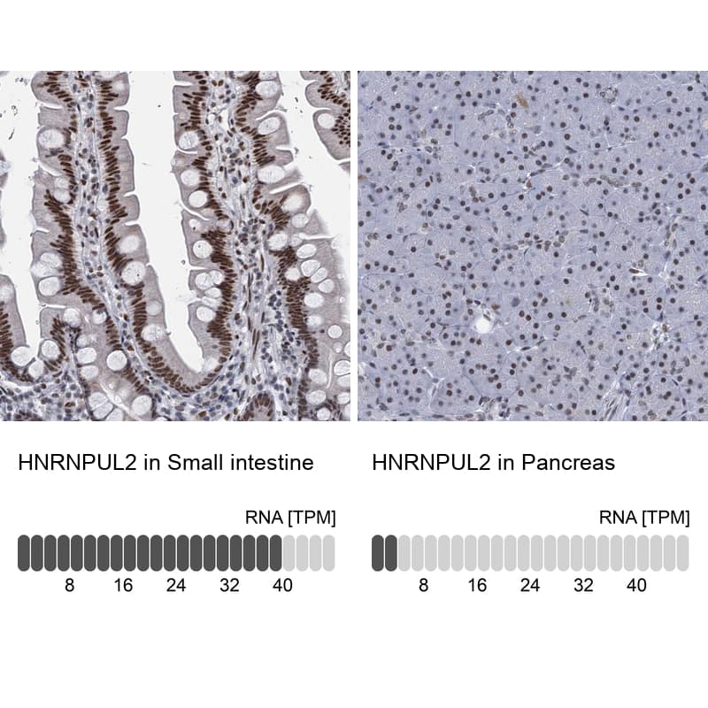 Analysis in human small intestine and pancreas tissues using NBP1-92001 antibody. Corresponding HNRNPUL2 RNA-seq data are presented for the same tissues.
