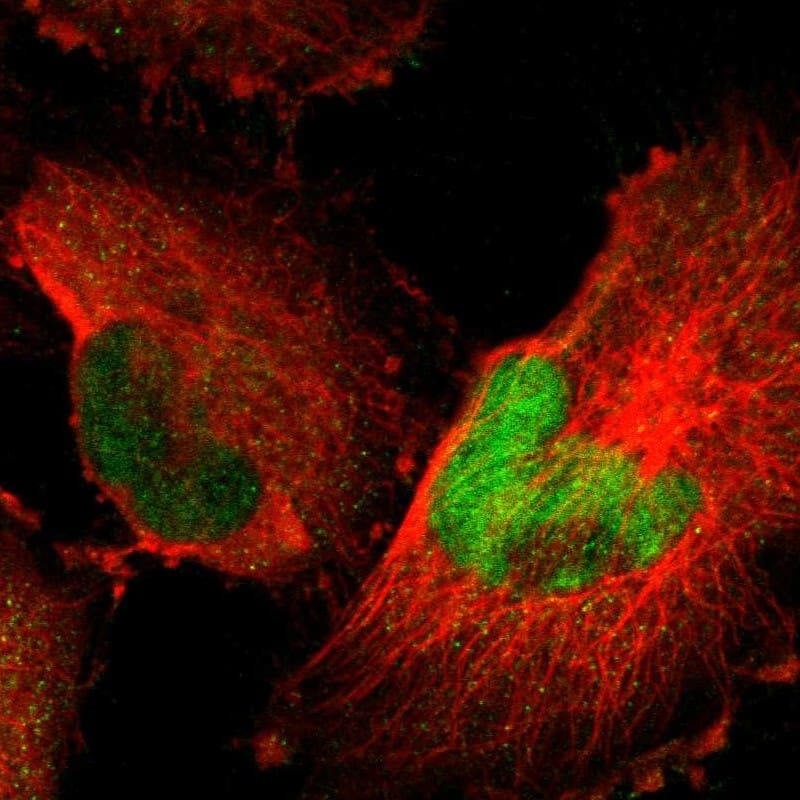 Staining of human cell line U-251 MG shows localization to nucleoplasm & cytosol.