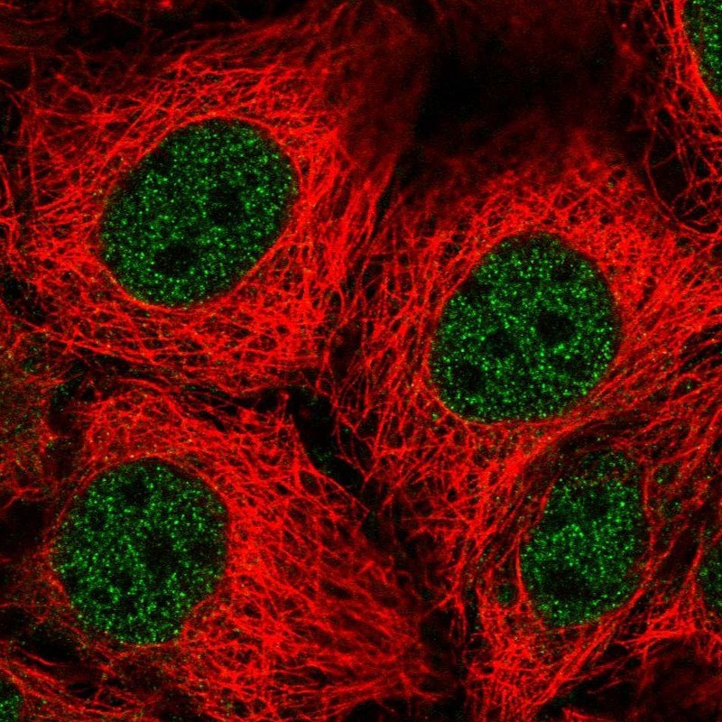Immunocytochemistry/ Immunofluorescence PEPT1/SLC15A1 Antibody - BSA Free