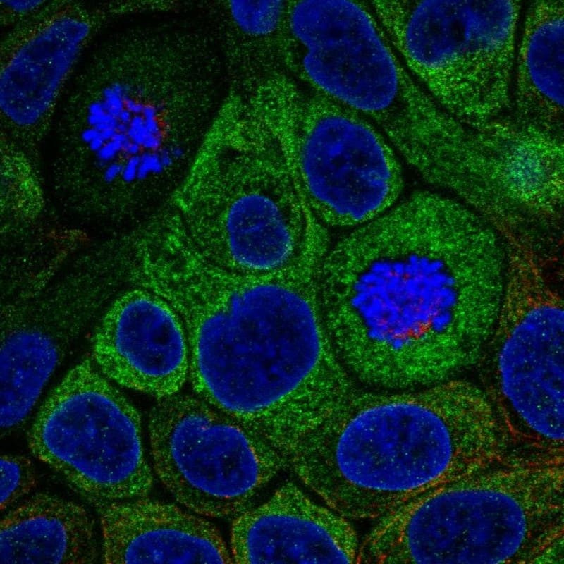 Staining of human cell line RT4 shows localization to endoplasmic reticulum.