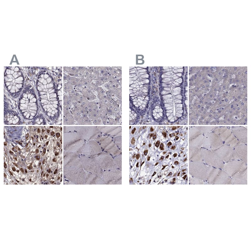 <b>Orthogonal Strategies Validation. </b>Staining of human colon, liver, placenta and skeletal muscle HPA038678 (A) shows similar protein distribution across tissues to independent antibody HPA038677 (B).