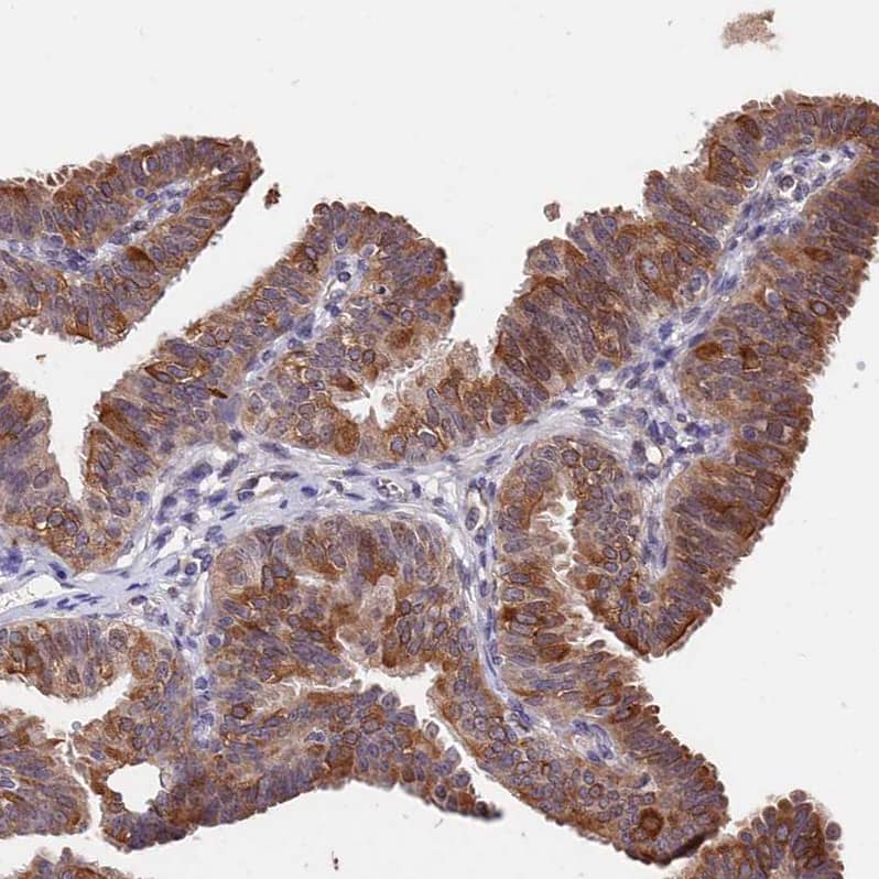 Immunohistochemistry INPP4A Antibody - BSA Free