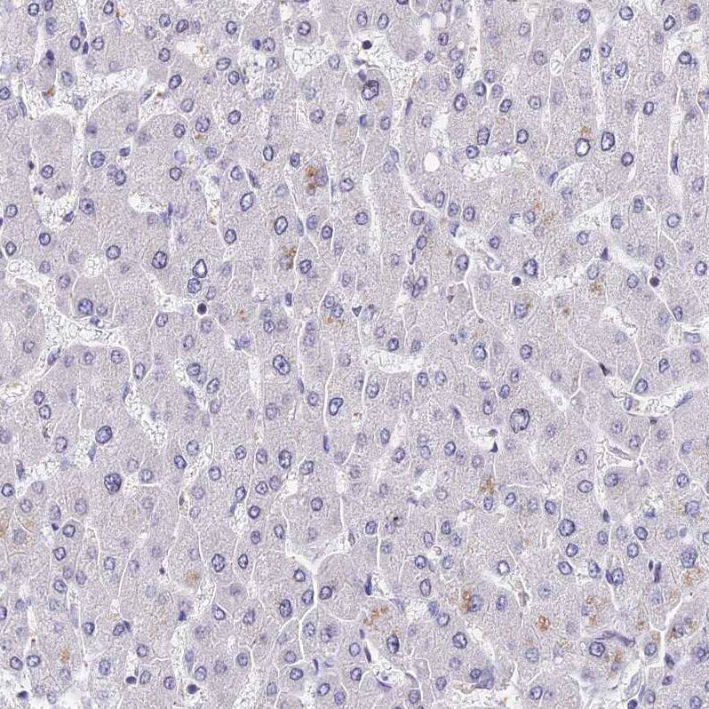 Immunohistochemistry INPP4A Antibody - BSA Free