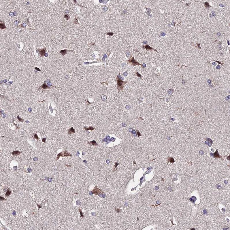 Immunohistochemistry INPP4A Antibody - BSA Free