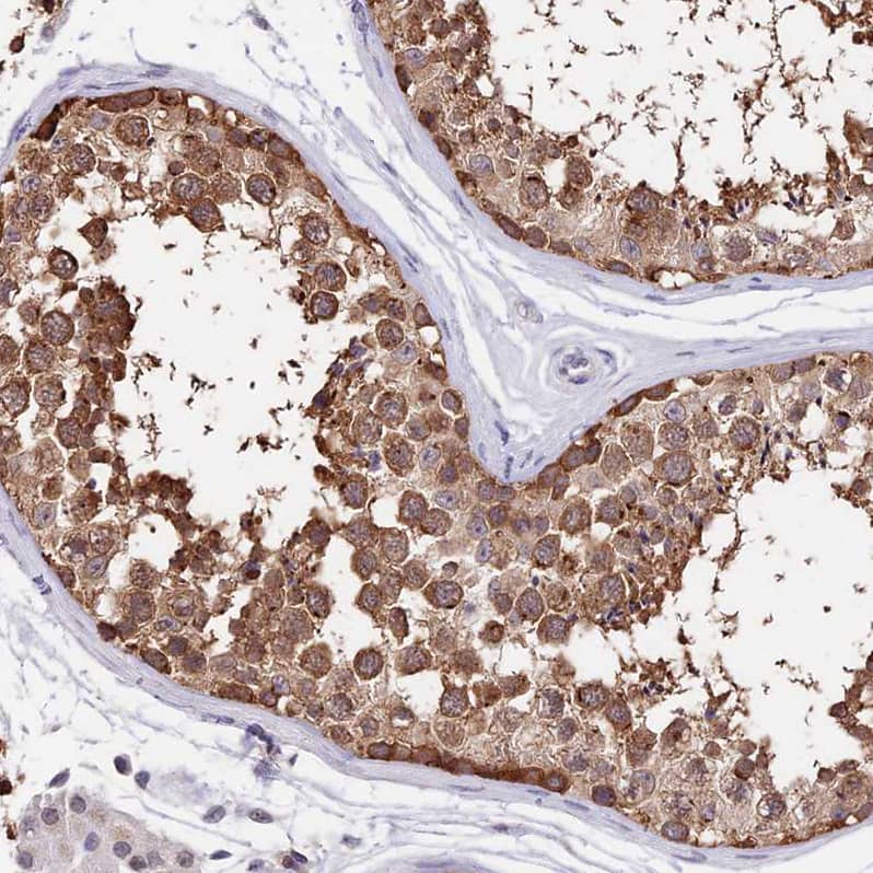 Immunohistochemistry INPP4A Antibody - BSA Free