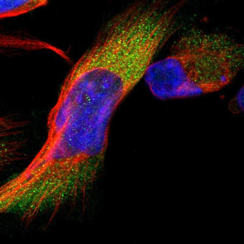 Staining of human cell line U-251 MG shows localization to cytosol.