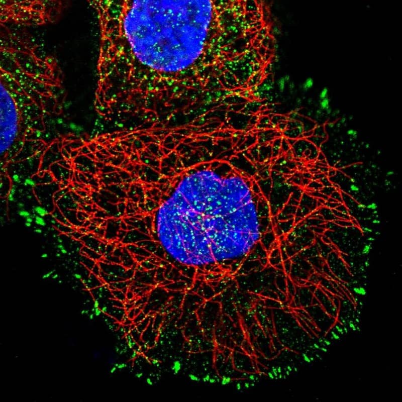 Staining of human cell line A-431 shows localization to cytosol & focal adhesion sites.