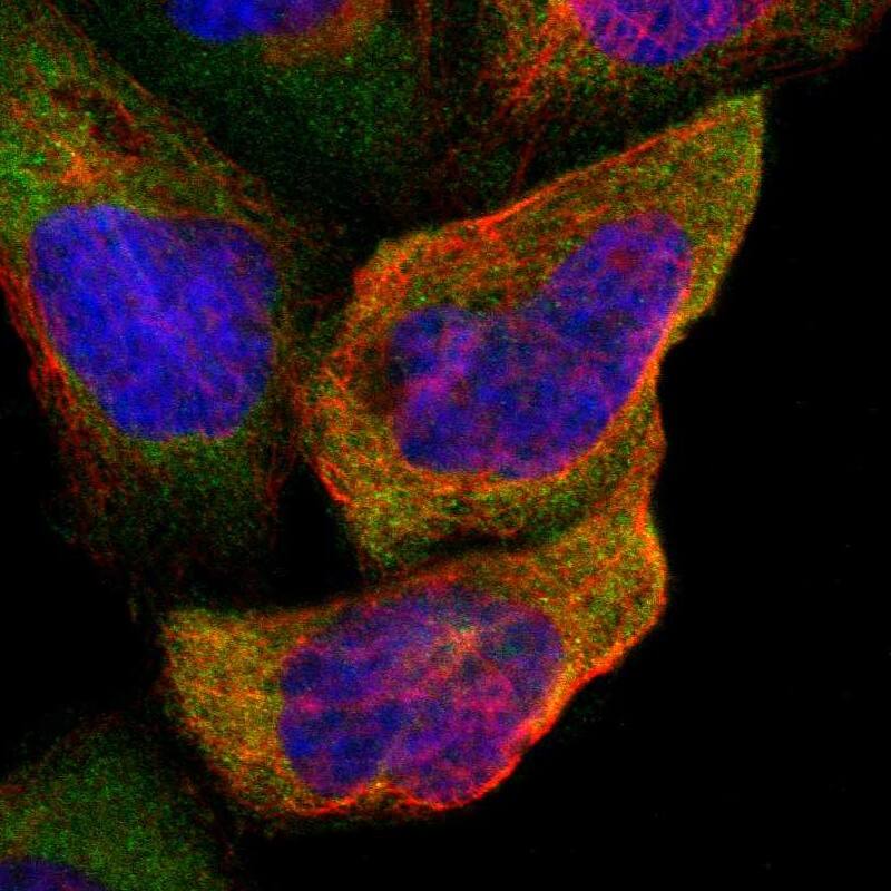 Staining of human cell line A-431 shows localization to cytosol.