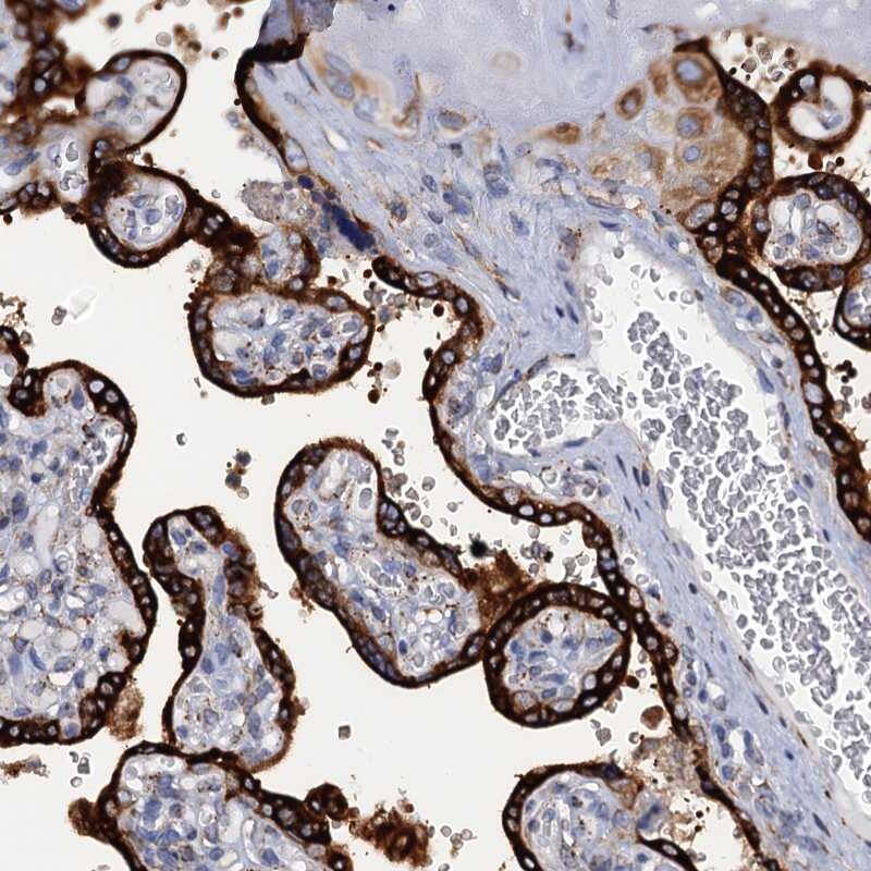 Immunohistochemistry-Paraffin KDELC2 Antibody - BSA Free
