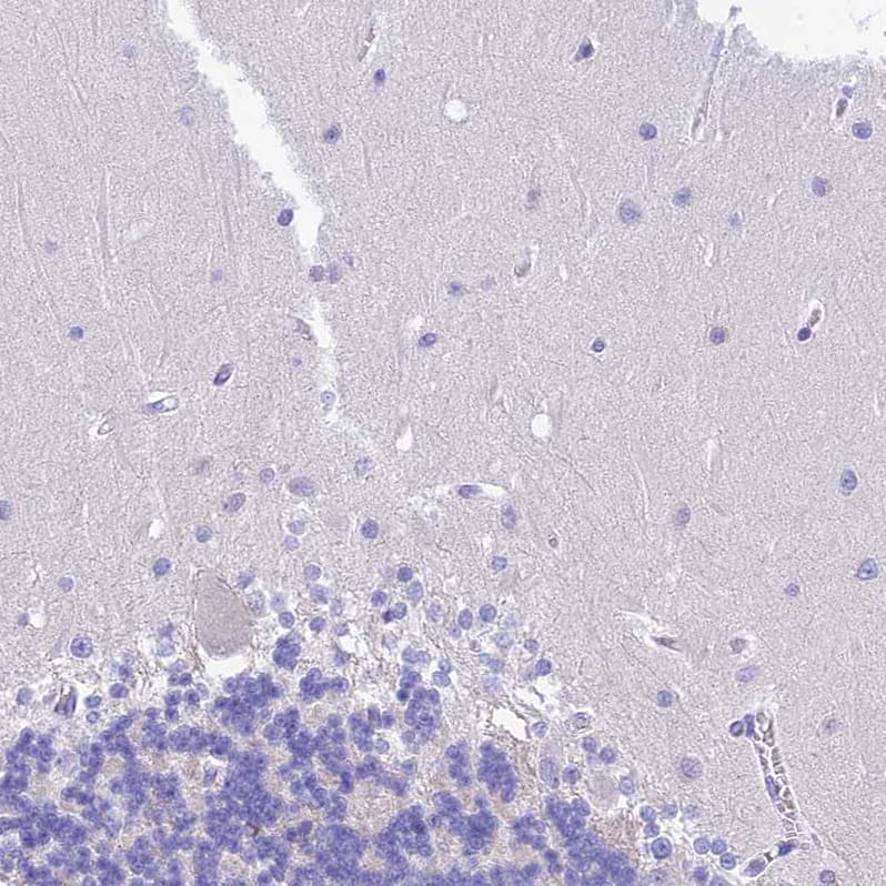 Staining of human cerebellum shows no positivity in Purkinje cells as expected.